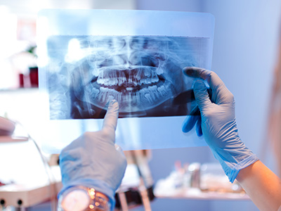 A dental professional in a lab, examining an X-ray of a patient s teeth and mouth.