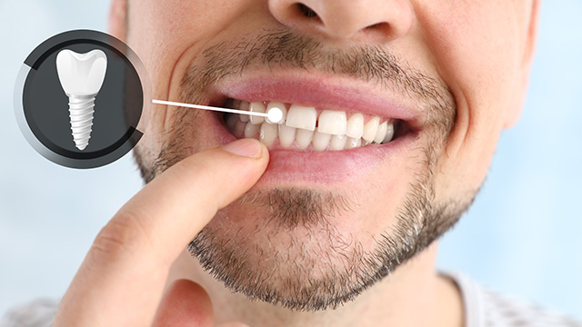 Image of a man brushing his teeth with an electric toothbrush, showcasing the device in action.