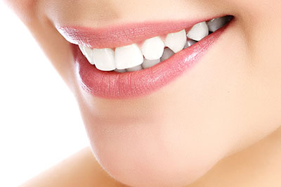 Alt tag  A close-up of a smiling woman with white teeth, showcasing dental care or oral hygiene.