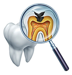 An illustration of a dental magnifier with an x-ray image showing a tooth and its root structure, highlighting the interior details.