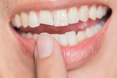 A person s hand holding a toothbrush in front of an open mouth with teeth.