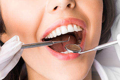 A person with a wide smile, wearing white gloves and holding a dental tool near their mouth.