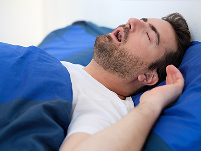 A man is lying in bed, appearing to be asleep with his mouth slightly open.